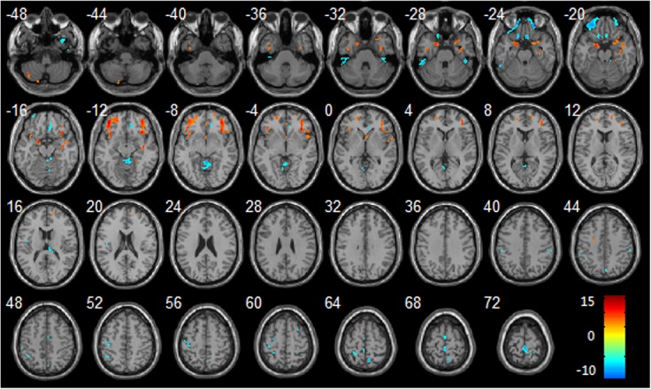 Fig 1