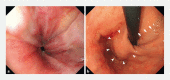 Fig. 1