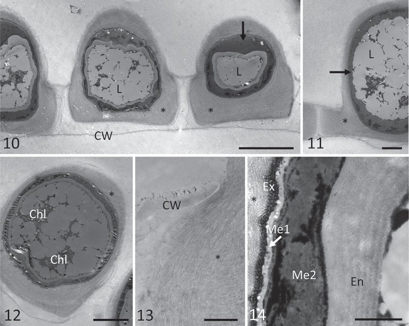 Figs 10–14.