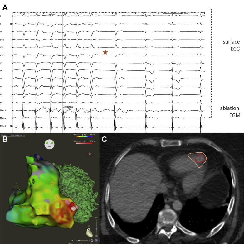 Figure 1