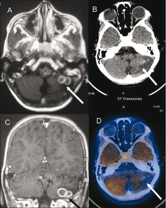 Figure 4 (A-D)