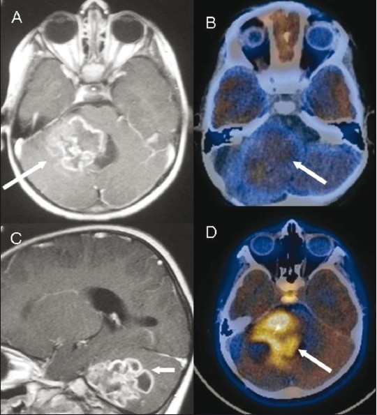 Figure 3 (A-D)