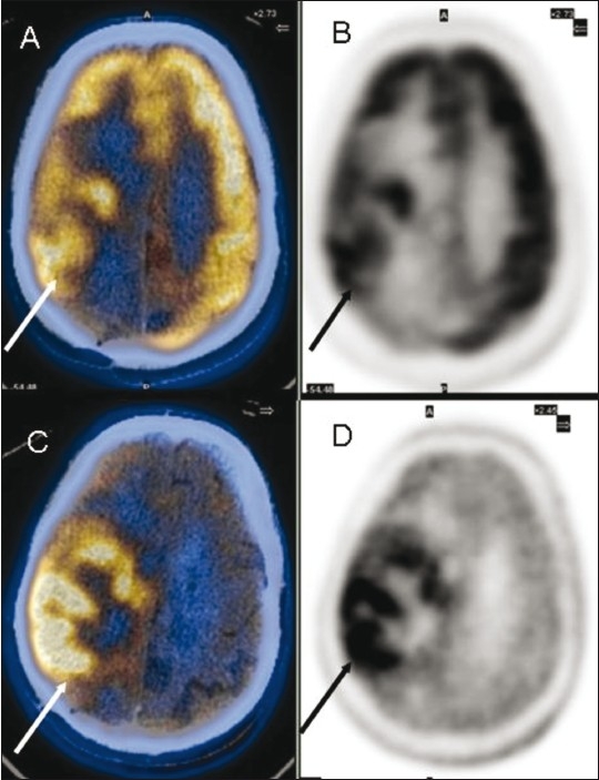 Figure 2 (A-D)