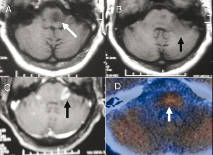 Figure 5 (A-D)