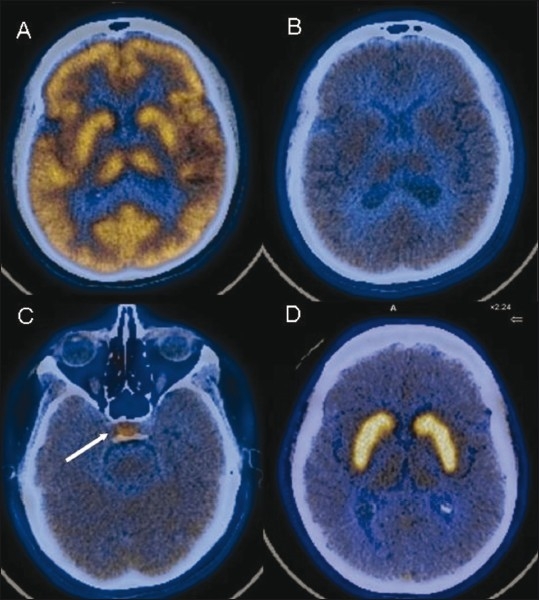 Figure 1 (A-D)