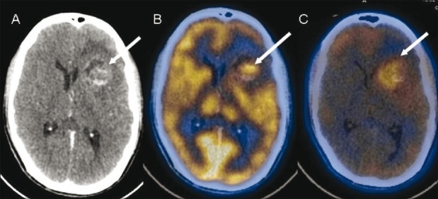 Figure 11 (A-C)