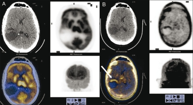 Figure 10 (A, B)