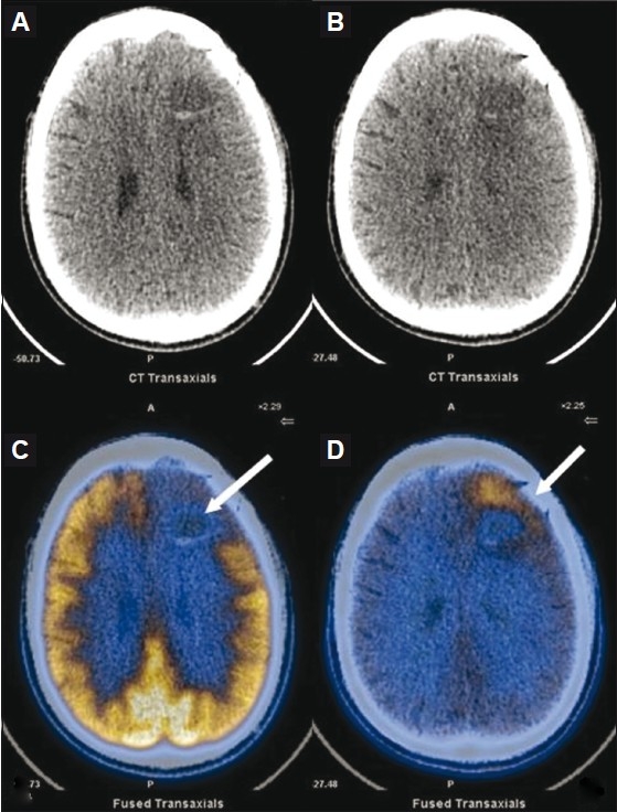 Figure 6 (A-D)