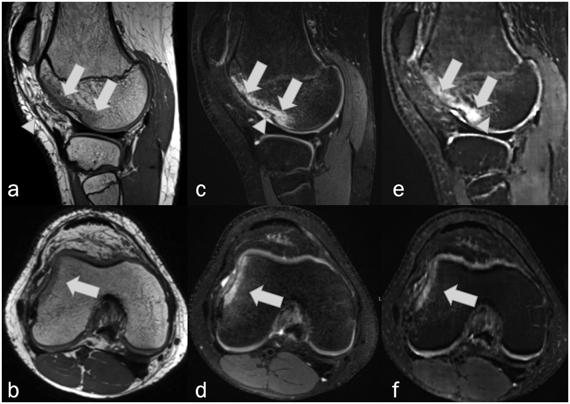 Figure 11.