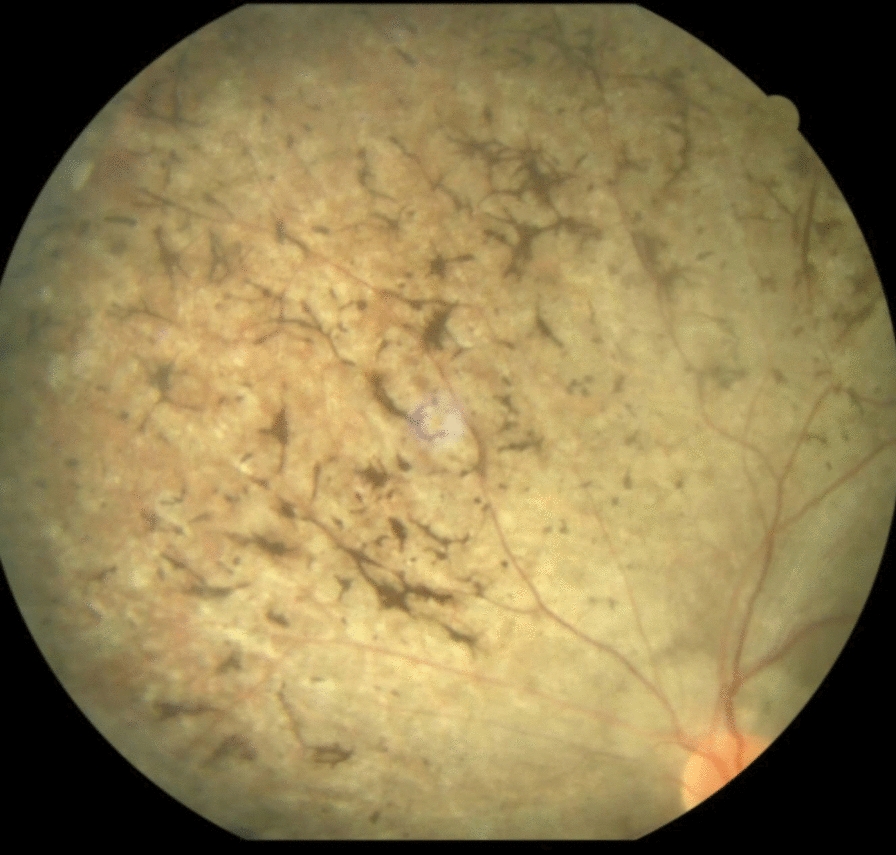 Fig. 1