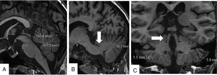 Fig 1.