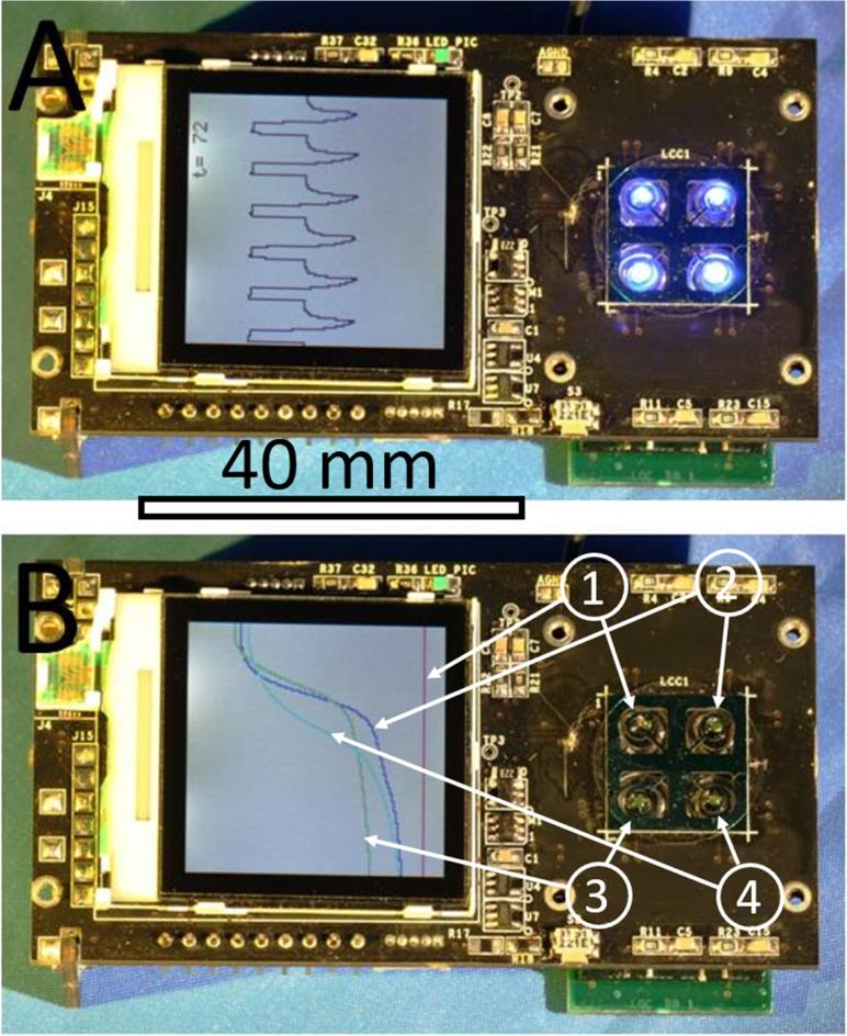 Figure 4