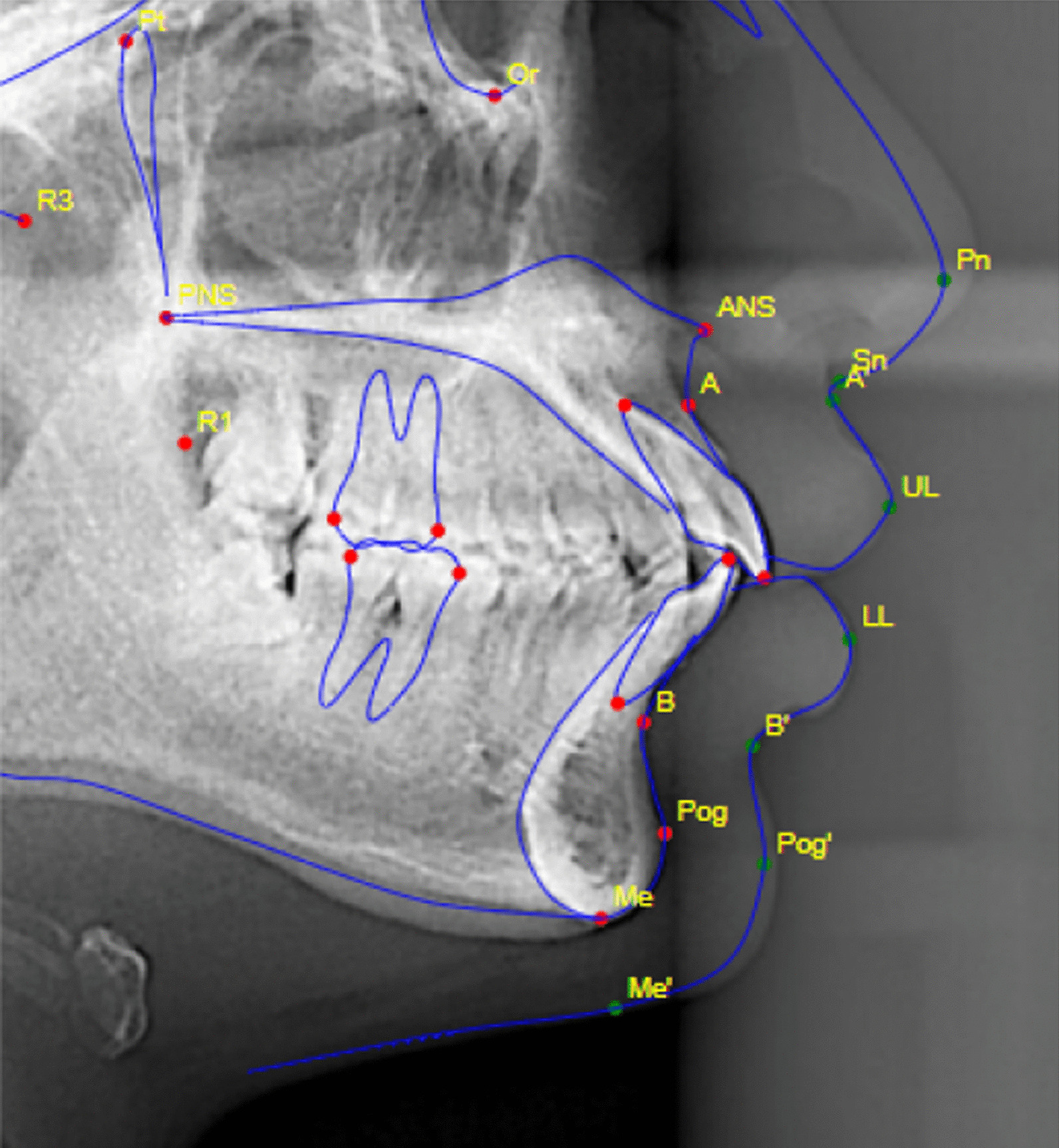 Fig. 3