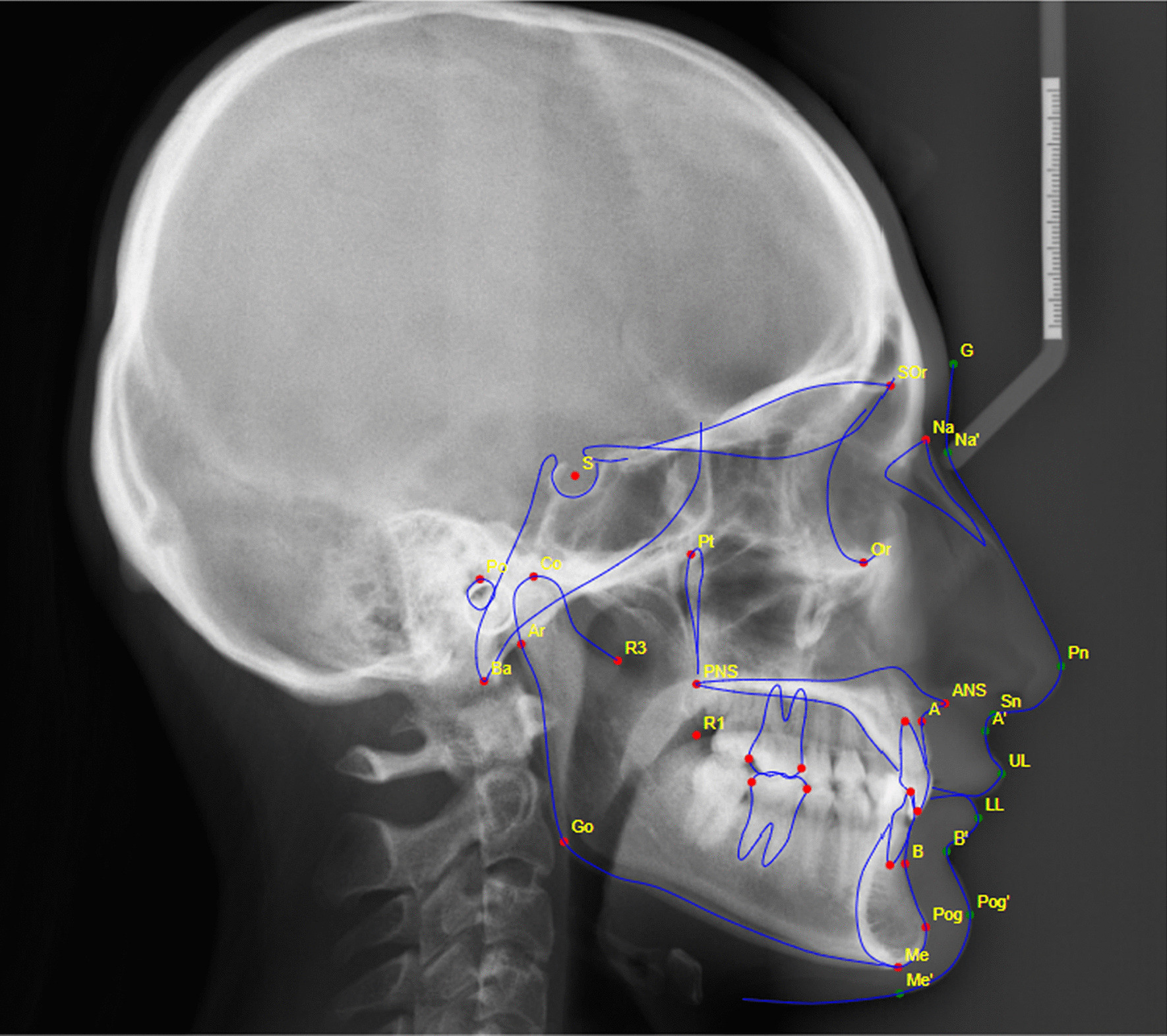 Fig. 2