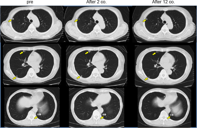 Fig. 1