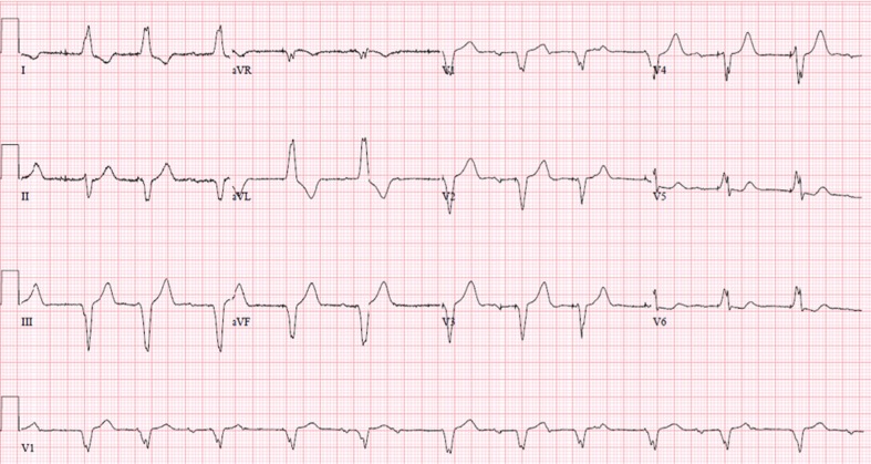 Figure 1: