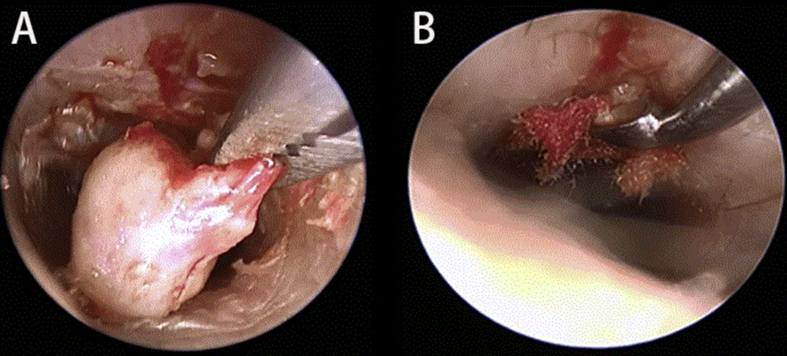 Fig. 2