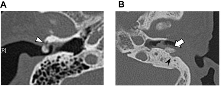 Fig. 1