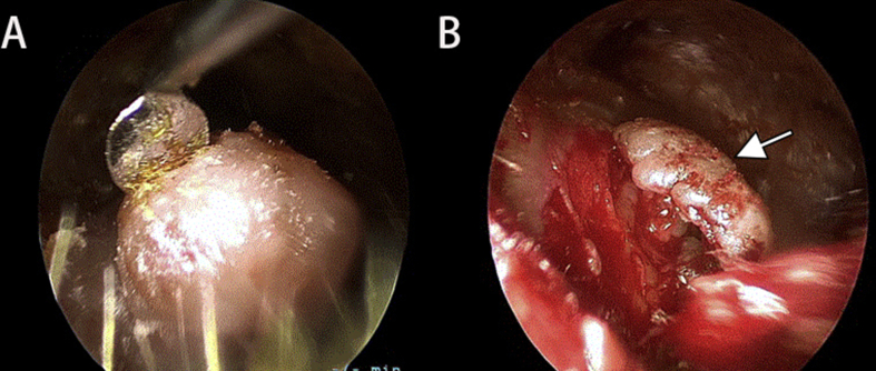 Fig. 3