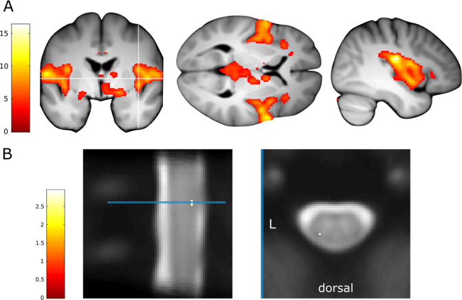 Figure 2—figure supplement 1.