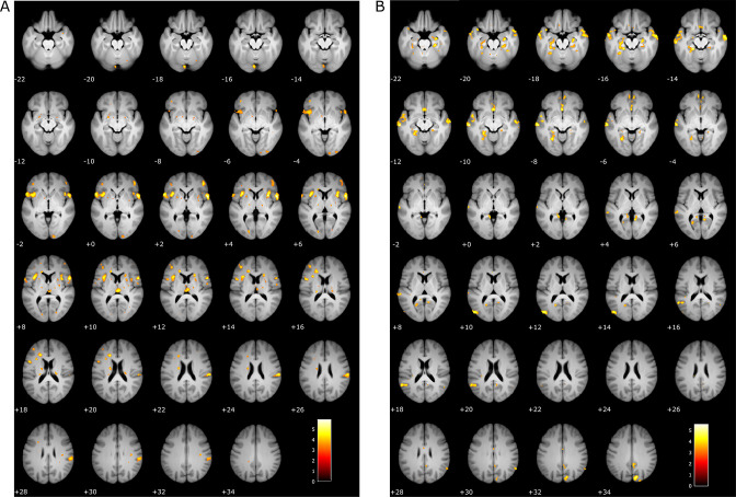 Figure 2—figure supplement 3.