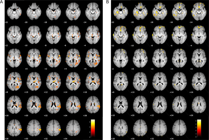 Figure 4—figure supplement 1.