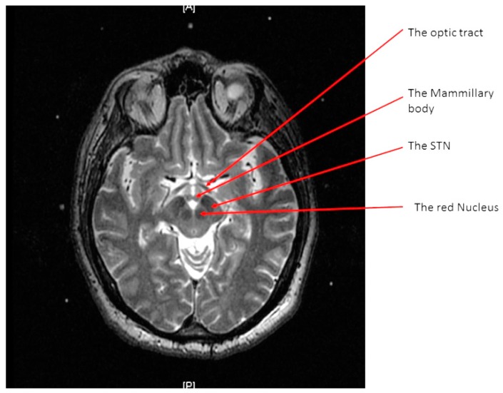 Figure 2