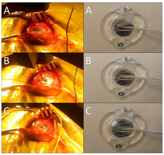 Figure 12