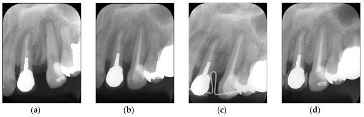 Figure 14