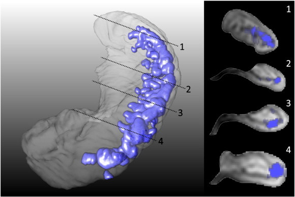 Fig. 3