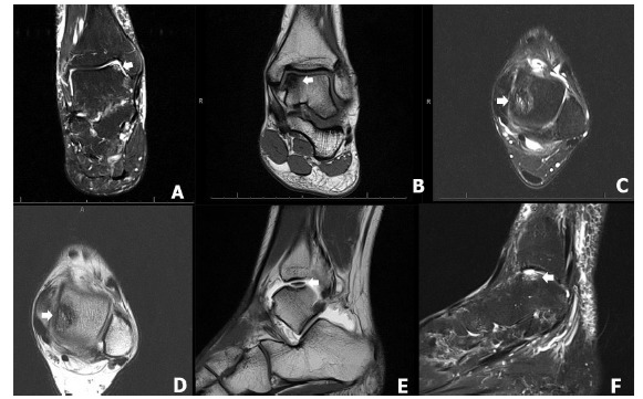 Fig. (2)