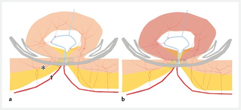 Fig. 4