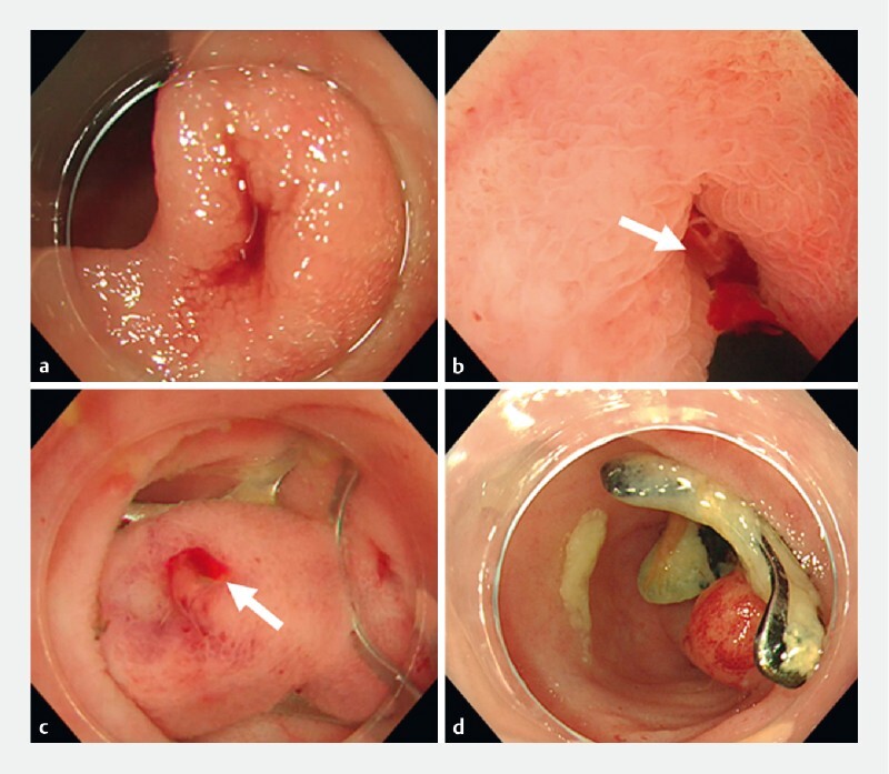 Fig. 3