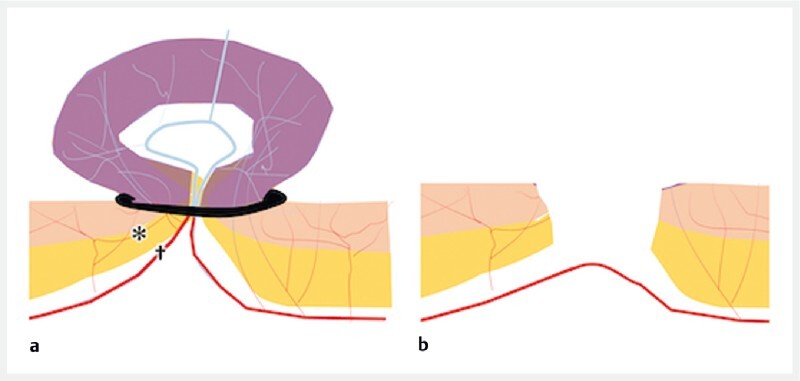 Fig. 1