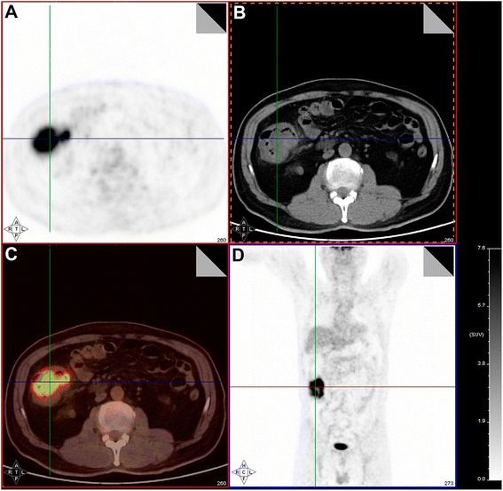 Fig. 4