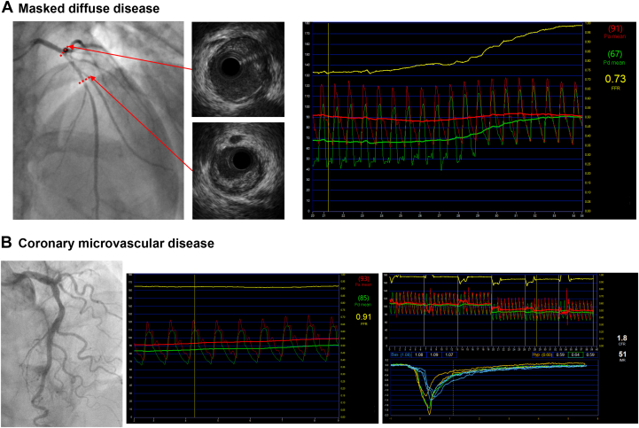 Figure 4