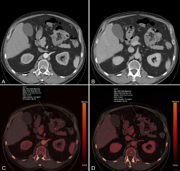 Fig. 2