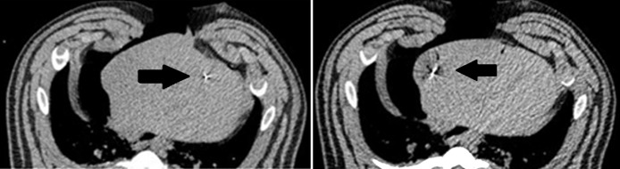 Figure 3b: