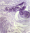 Fig. 12