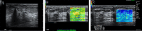 Figure 3