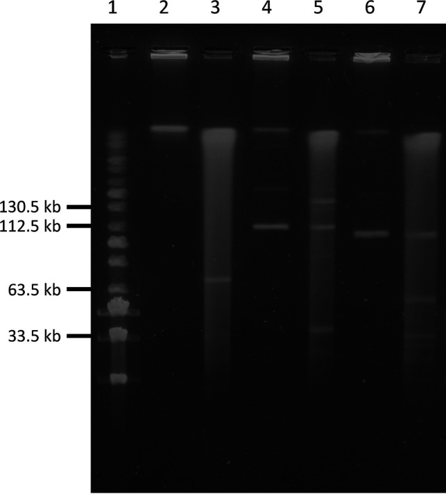 Gel electrophoresis depicts DNA fragments of varying sizes. Lane 1 is a molecular weight marker while lanes 2 to 7 depict DNA samples with different bands corresponding to fragment sizes.