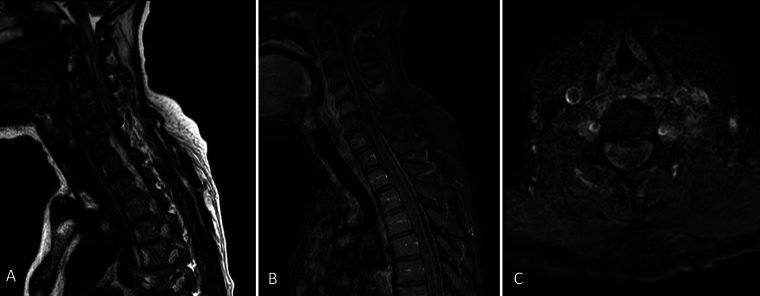 FIG. 1.