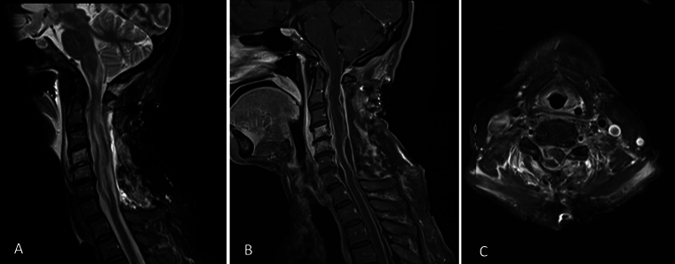 FIG. 2.