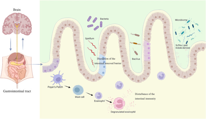 FIGURE 1