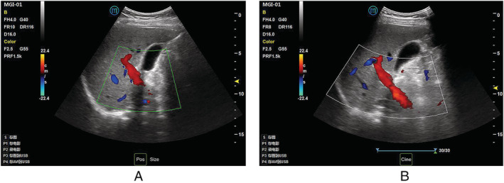 Figure 4