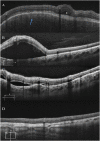 Fig. 3