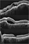 Fig. 5