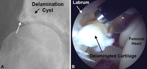 Fig. 2A–B