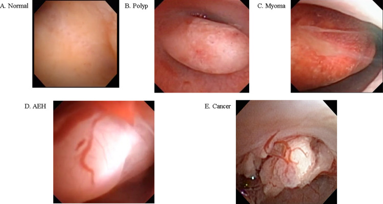 Fig 1