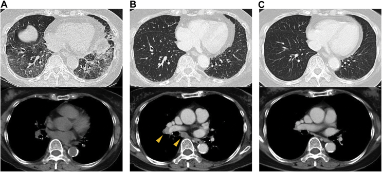 Figure 1